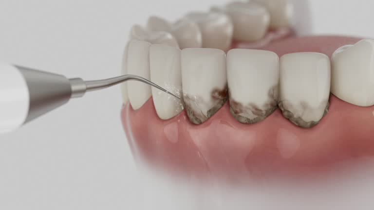 Reliable Dental contractor in Seminole Manor, FL by Dentist Open Now